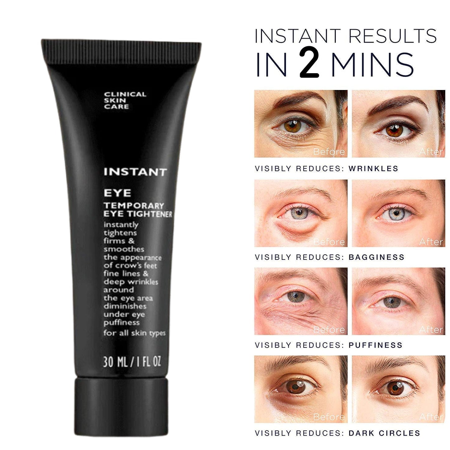 Collagen Wrinkle & Eye Bag Removal Cream | Instant Results Within 2 minutes